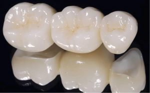 rs zirconia dc
