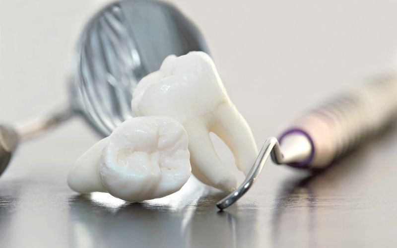 Mọc răng khôn đau mấy ngày? Cách giảm đau hiệu quả 2 moc rang khon dau may ngay cach giam dau hieu qua 3