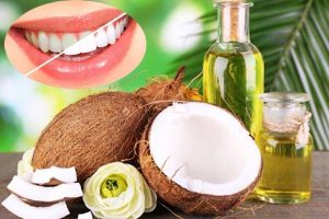 Phương pháp làm trắng răng nào tốt nhất cho bạn? 1 phuong phap lam trang rang nao tot nhat cho ban 2